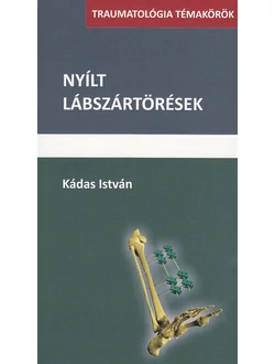 Nyílt lábszártörések