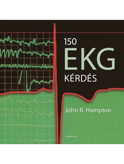150 EKG kérdés