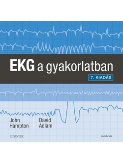 EKG a gyakorlatban