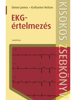 EKG-értelmezés