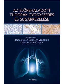 Az előrehaladott tüdőrák gyógyszeres és sugárkezelése