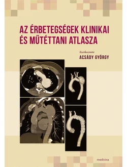Az érbetegségek klinikai és műtéttani atlasza