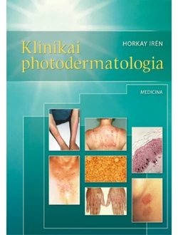 Klinikai photodermatologia