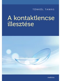 A kontaktlencse illesztése