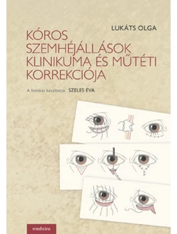 Kóros szemhéjállások klinikuma és műtéti korrekciója