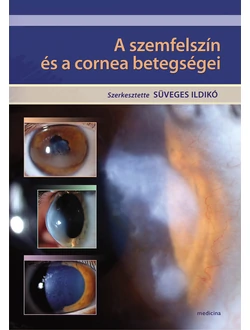 A szemfelszín és a cornea betegségei