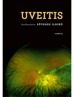 Uveitis