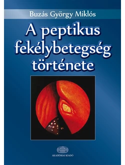 A peptikus fekélybetegség története