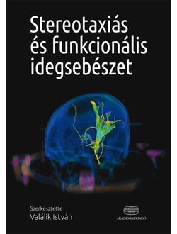 Stereotaxiás és funkcionális idegsebészet