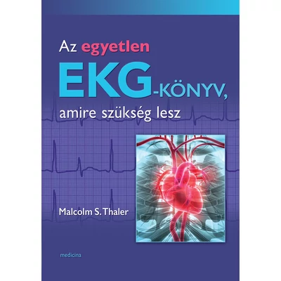 Az egyetlen EKG-könyv, amire szükség lesz