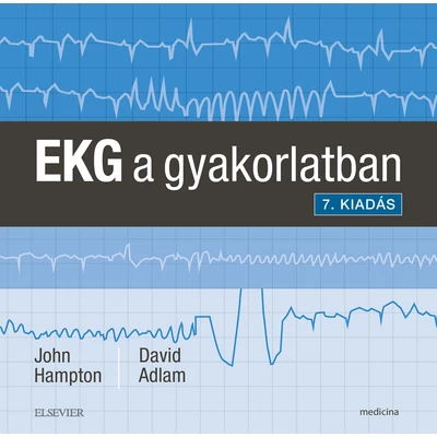 EKG a gyakorlatban