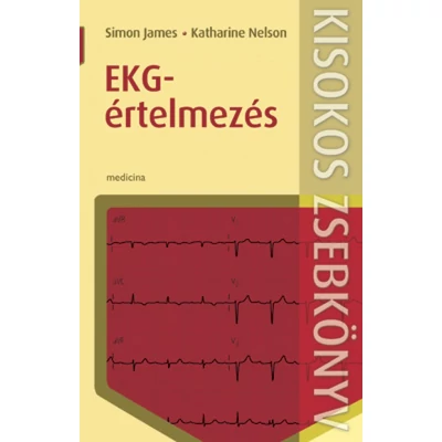 EKG-értelmezés