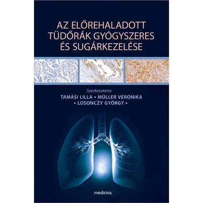 Az előrehaladott tüdőrák gyógyszeres és sugárkezelése