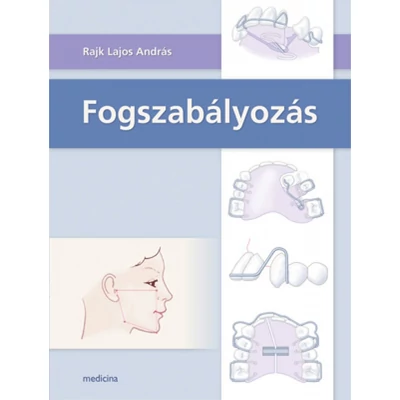 Fogszabályozás