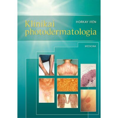 Klinikai photodermatologia