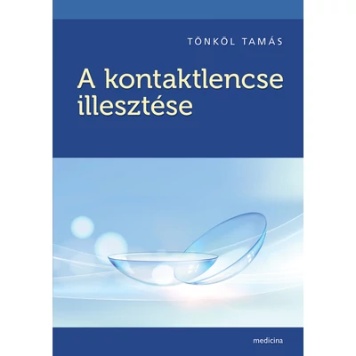 A kontaktlencse illesztése