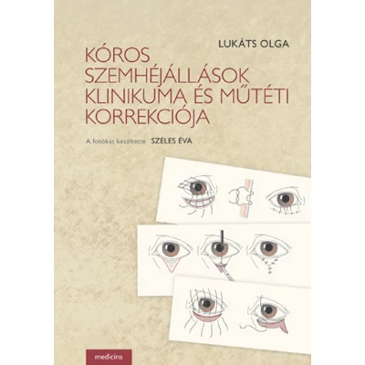 Kóros szemhéjállások klinikuma és műtéti korrekciója