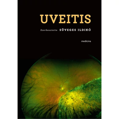 Uveitis