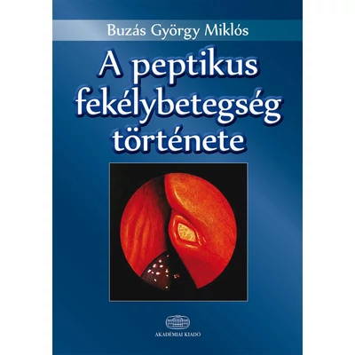 A peptikus fekélybetegség története