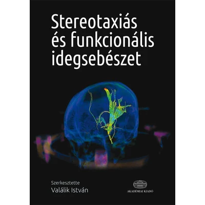 Stereotaxiás és funkcionális idegsebészet