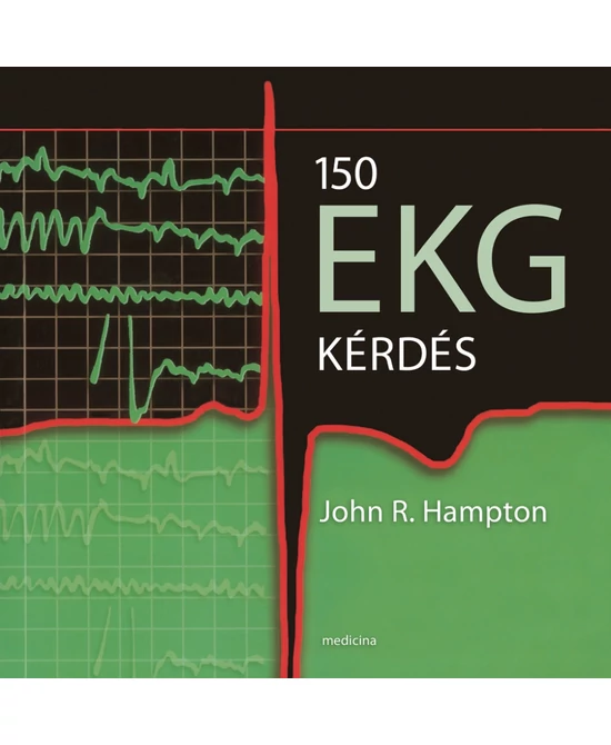 150 EKG kérdés