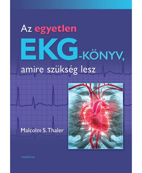 Az egyetlen EKG-könyv, amire szükség lesz