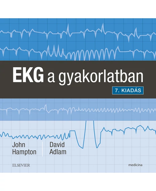 EKG a gyakorlatban