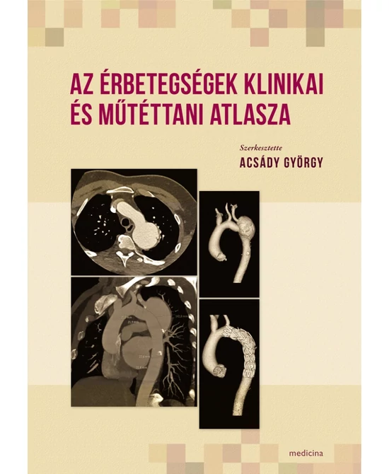 Az érbetegségek klinikai és műtéttani atlasza