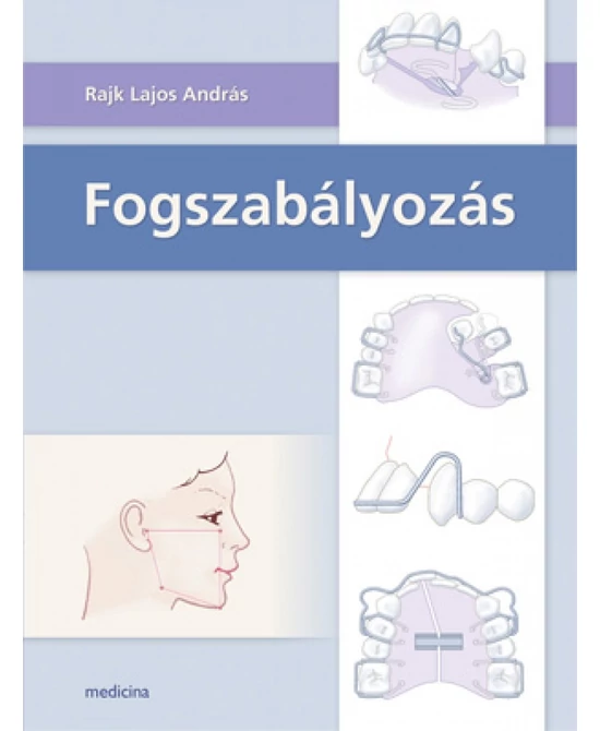 Fogszabályozás