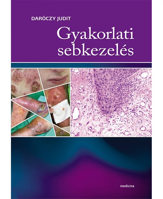 Gyakorlati sebkezelés