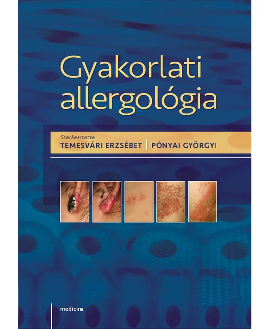 Gyakorlati allergológia