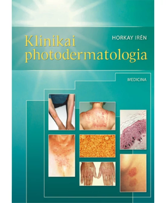 Klinikai photodermatologia