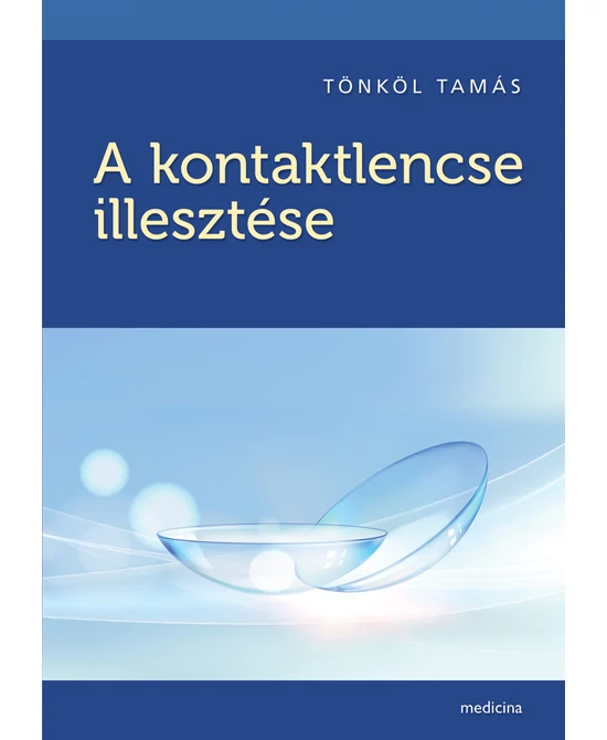 A kontaktlencse illesztése