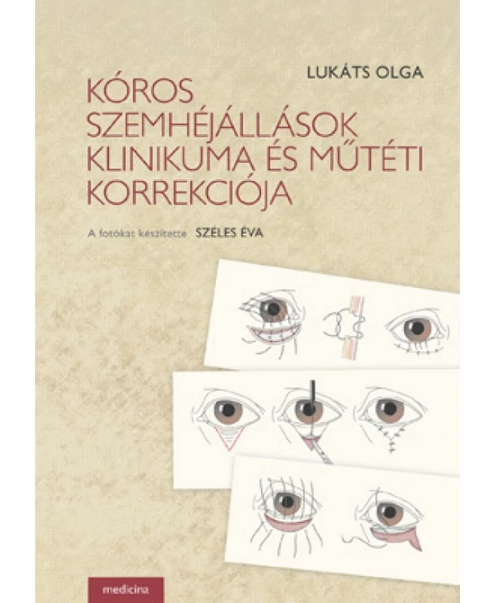 Kóros szemhéjállások klinikuma és műtéti korrekciója