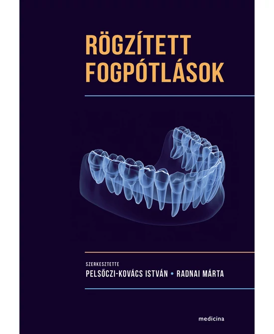 Rögzített fogpótlások