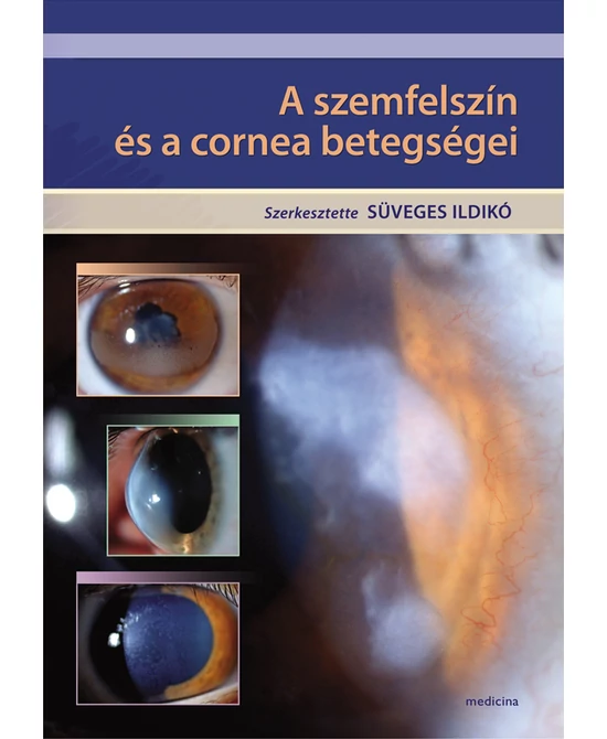 A szemfelszín és a cornea betegségei