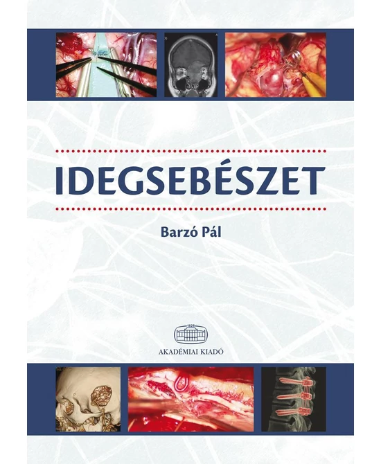 Idegsebészet