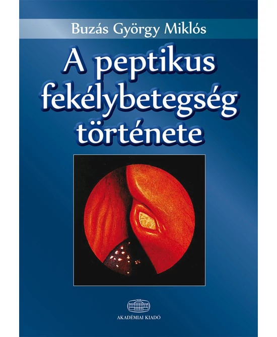 A peptikus fekélybetegség története