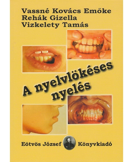 A nyelvlökéses nyelés