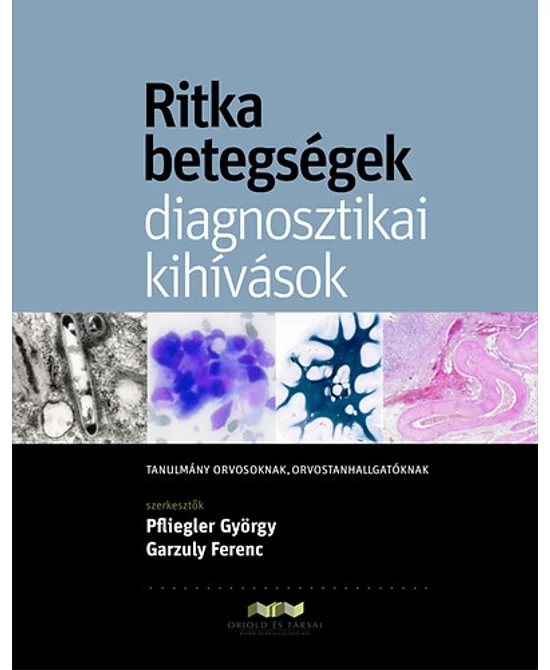 Ritka betegségek - diagnosztikai kihívások