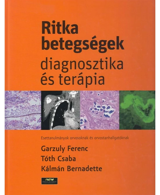 Ritka betegségek – diagnosztika és terápia