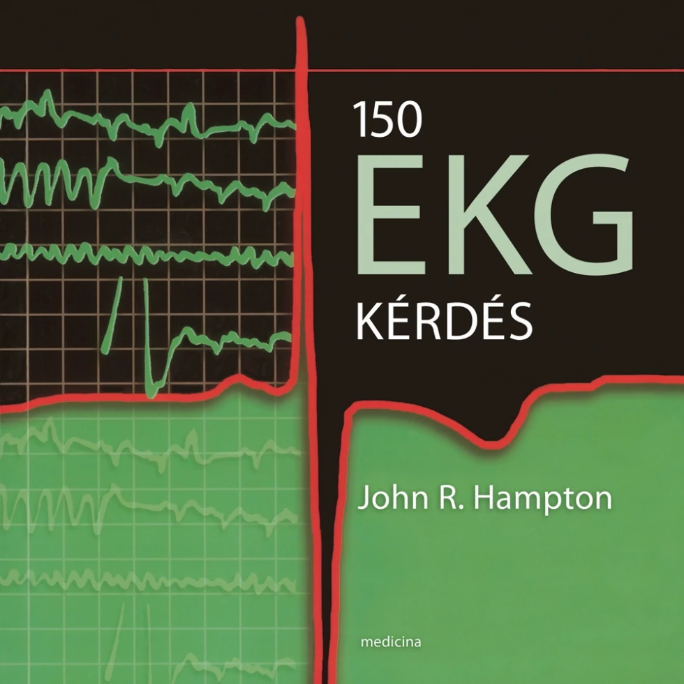 150 EKG kérdés