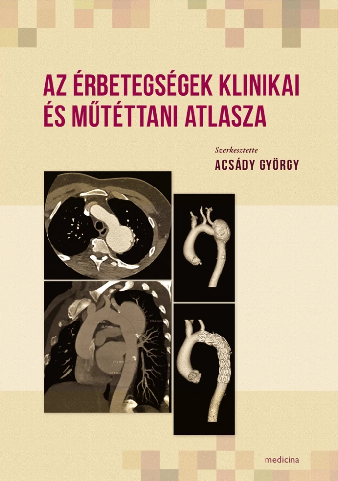 Az érbetegségek klinikai és műtéttani atlasza