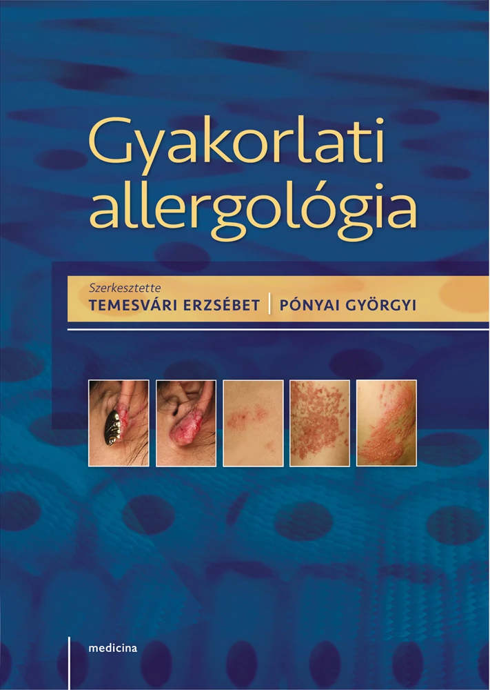 Gyakorlati allergológia