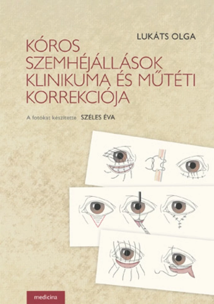 Kóros szemhéjállások klinikuma és műtéti korrekciója