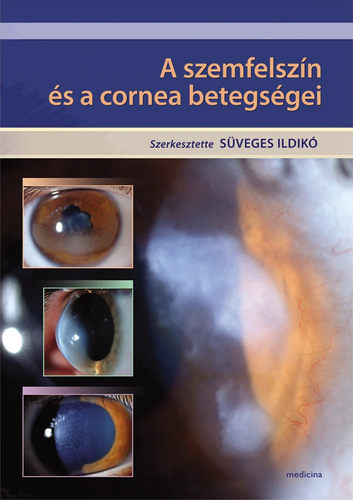 A szemfelszín és a cornea betegségei