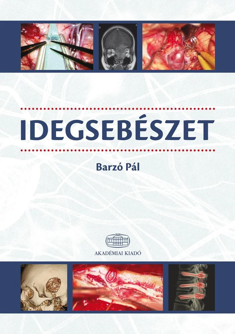 Idegsebészet