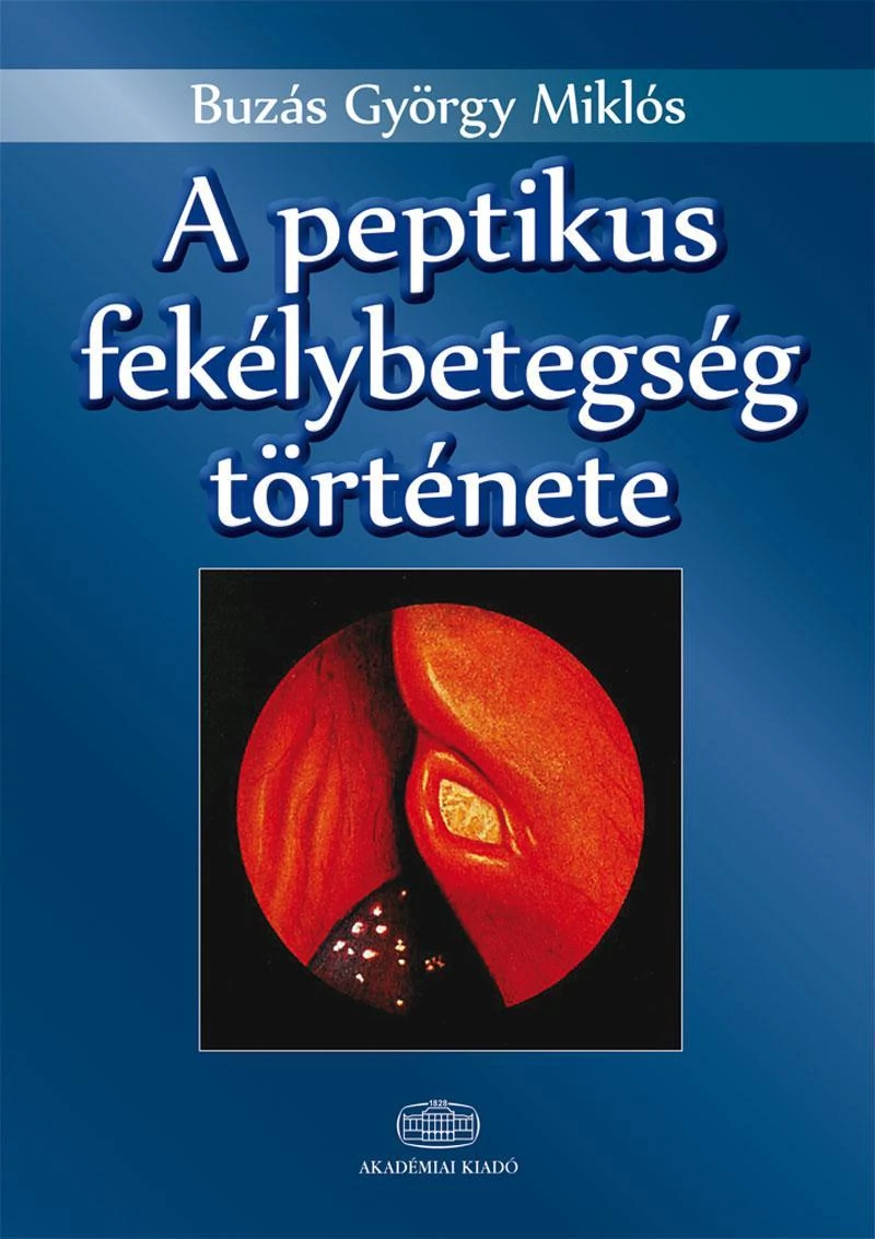 A peptikus fekélybetegség története