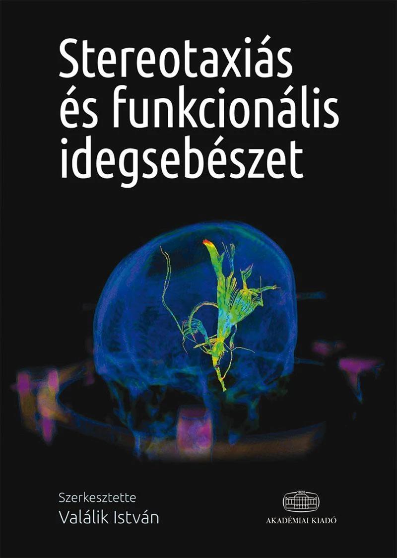 Stereotaxiás és funkcionális idegsebészet