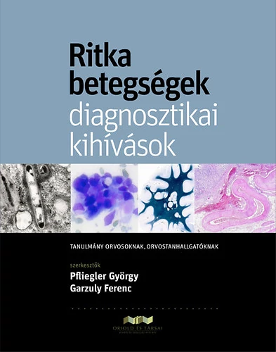 Ritka betegségek - diagnosztikai kihívások